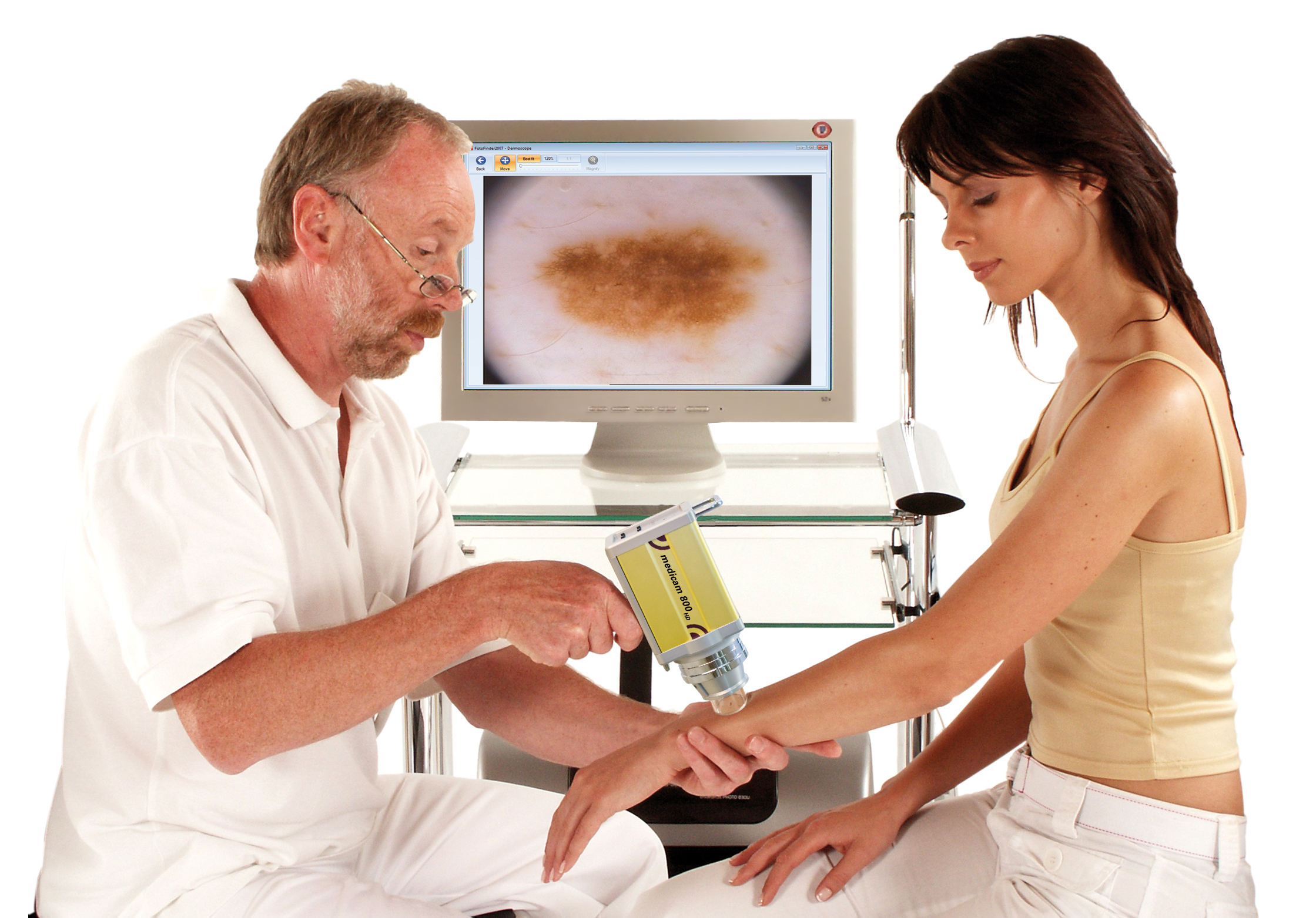 Dermatoscopía digital: una importante herramienta en el diagnóstico precoz de melanoma