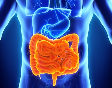 ¿A qué llamamos Enfermedad Inflamatoria Intestinal (EII)?