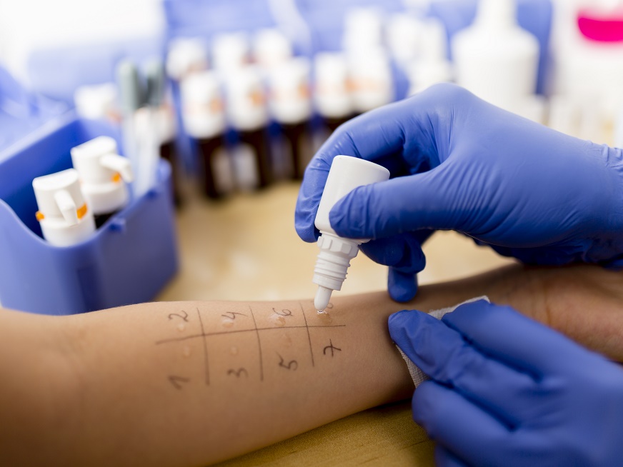 ¿Tenés alergia? Conocé qué estudios podes realizarte