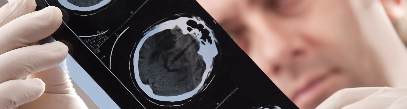 Unidad de Enfermedades Neurológicas Vasculares Agudas