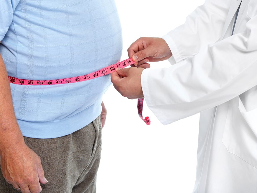 Obesidad Severa: Cirugía Bariátrica, una solución posible