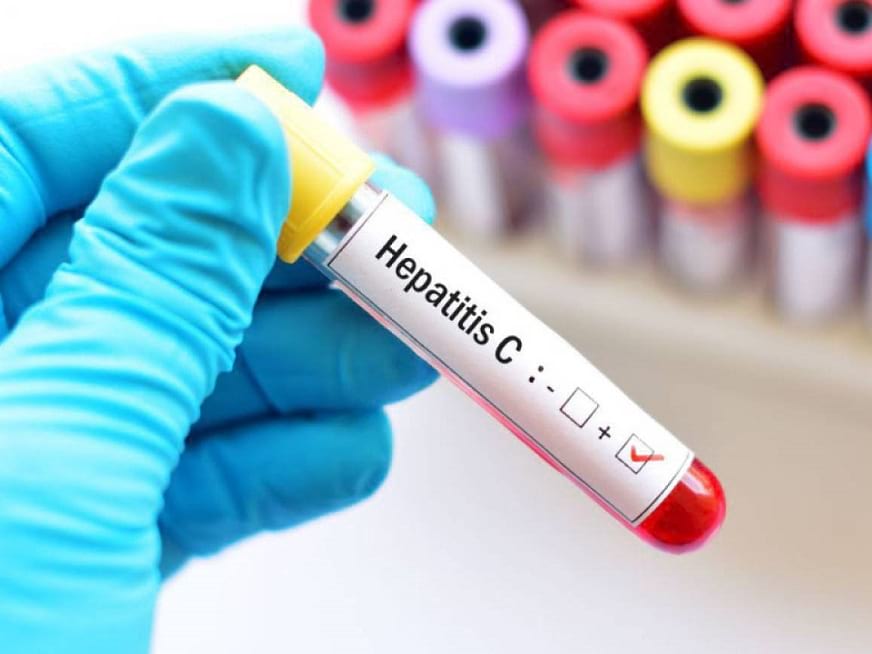 Día Mundial de la Hepatitis C