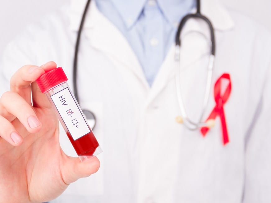 Infecciones de Transmisión Sexual