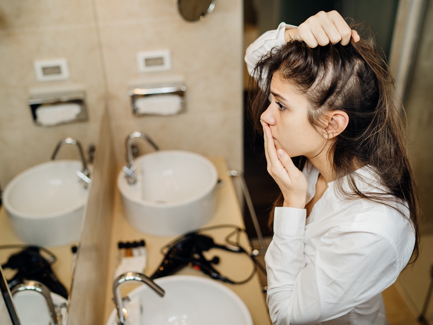 Alopecia en pandemia