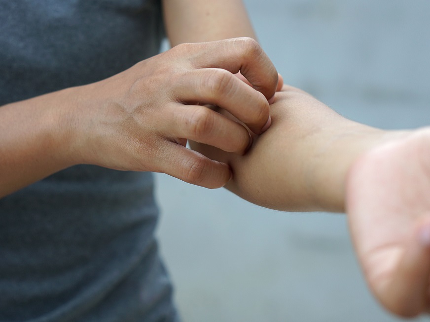 Hablemos de Dermatitis Atópica