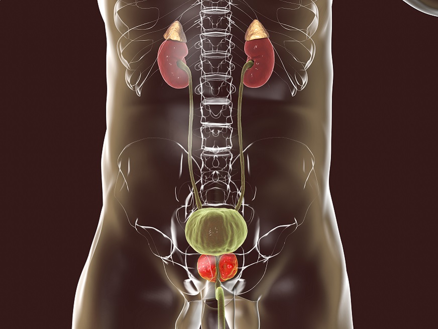 Rezum, una terapia sin cirugía para tratar la Hiperplasia de Próstata