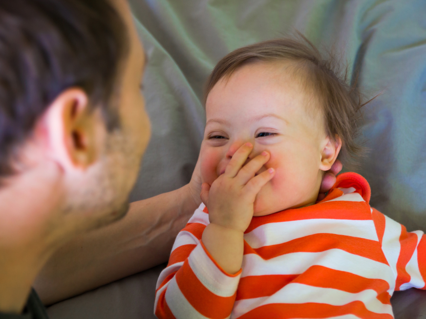 Hablemos de Síndrome de Down