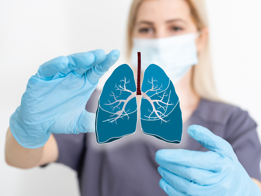 Lluvia Negra: un peligro ambiental y de salud