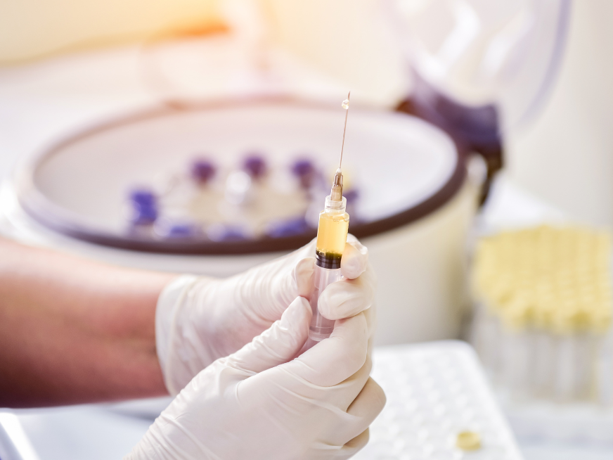 ¿Qué es el plasma rico en plaquetas y cómo se usa en Ginecología?